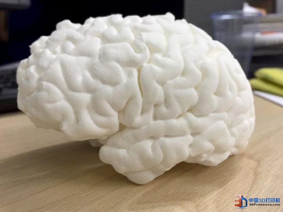 未來醫(yī)療行業(yè) 3D打印技術(shù)融入其中的四種方式

3D醫(yī)療行業(yè),3D打印心臟,3D打印大腦,3D打印應(yīng)用,3D打印領(lǐng)域,3D打印和醫(yī)療的關(guān)系,3D打印平臺(tái),3D打印服務(wù),3d打印企業(yè)服務(wù)平臺(tái)