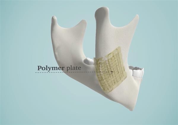 解決醫生煩惱 3D打印生物陶瓷修復骨骼


生物陶瓷,3D打印生物陶瓷,工業3d打印機,3D打印機價格,3D打印服務,3D打印技術,中國3d打印技術,上海3D打印,北京3D打印