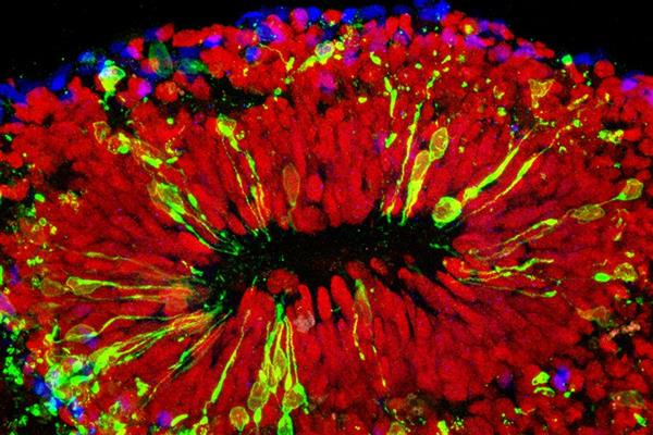 科學(xué)家攻克Zika病毒 高中生攜3D打印來(lái)幫忙

Zika病毒,3D打印醫(yī)療行業(yè),3D打印材料價(jià)格,3D打印技術(shù),3D打印材料,3D打印成本,3D打印價(jià)格