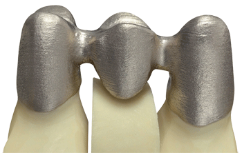 德國率先引入3D打印牙齒技術 全程體驗“無痛”種牙-e鍵打印|3D打印服務
3d打印牙齒,3D打印種牙,無痛種牙,3D打印平臺,3D打印服務,南京哪里有3D打印,南京3D打印廠家,南京3D打印服務