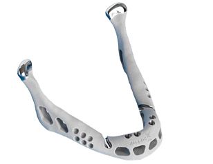 3d打印下頜骨成功移植 置換人體器官不再是夢-e鍵打印|3D打印服務(wù)
醫(yī)療3d打印技術(shù),3D打印下頜骨,3D打印人體器官,3D打印器官,3D打印心臟,3D打印假肢,3D打印大腦,3D打印技術(shù),3D打印服務(wù),3D打印云平臺