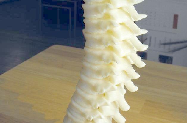 3D打印人體椎骨