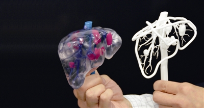 簡述3D打印技術(shù)在醫(yī)療行業(yè)應(yīng)用情況_e鍵3D打印服務(wù)