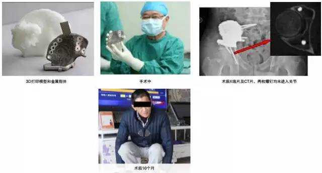 3d打印在醫(yī)療領域的應用 3D打印與醫(yī)療行業(yè)白皮書 3d打印在醫(yī)療領域的應用 3D打印與醫(yī)療行業(yè)白皮書