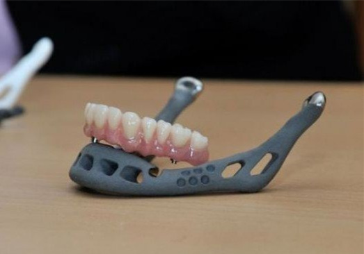 醫(yī)療3D打印的假牙 新手選擇3D打印手板模型加工打樣還是CNC加工?選擇當?shù)剡€是全國3D打印公司? 醫(yī)療3D打印的假牙 新手選擇3D打印手板模型加工打樣還是CNC加工?選擇當?shù)剡€是全國3D打印公司?