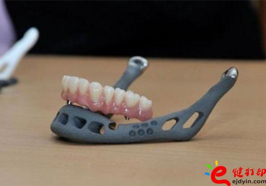 3D打印牙嵌體和牙套哪種更好？3D打印牙齒/隱形牙套/牙冠/模型/成品價(jià)格表