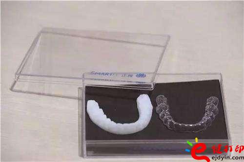 3D打印牙嵌體和牙套哪種更好？3D打印牙齒/隱形牙套/牙冠/模型/成品價(jià)格表