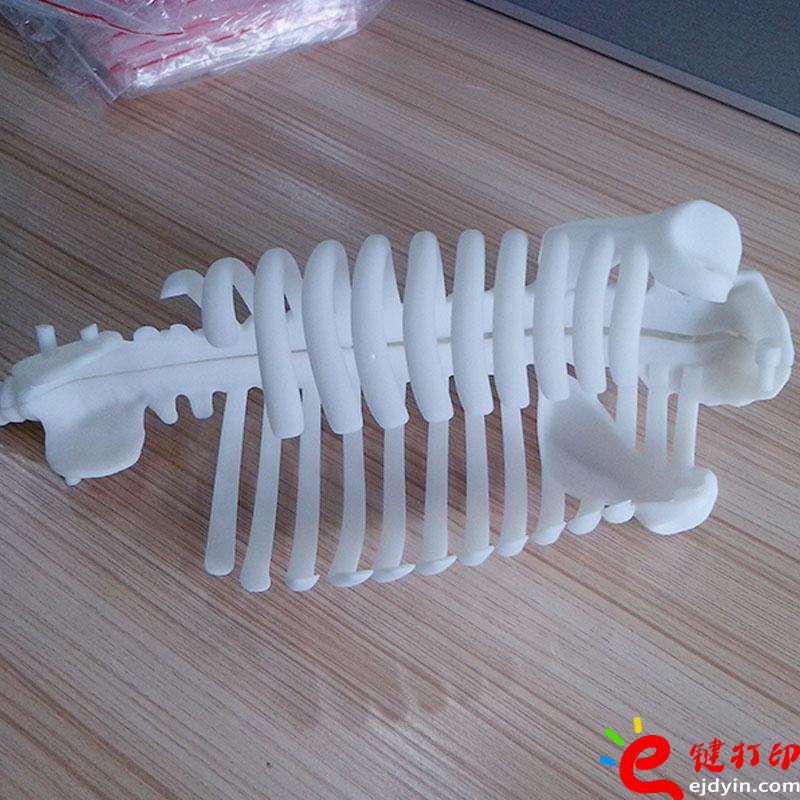醫療3D打印骨骼模型、3d打印定制手板,3d打印加工手板,3d打印手板模型,3d打印模型,深圳3d打印手板,3d打印手板工廠,工業級3d打印手板公司